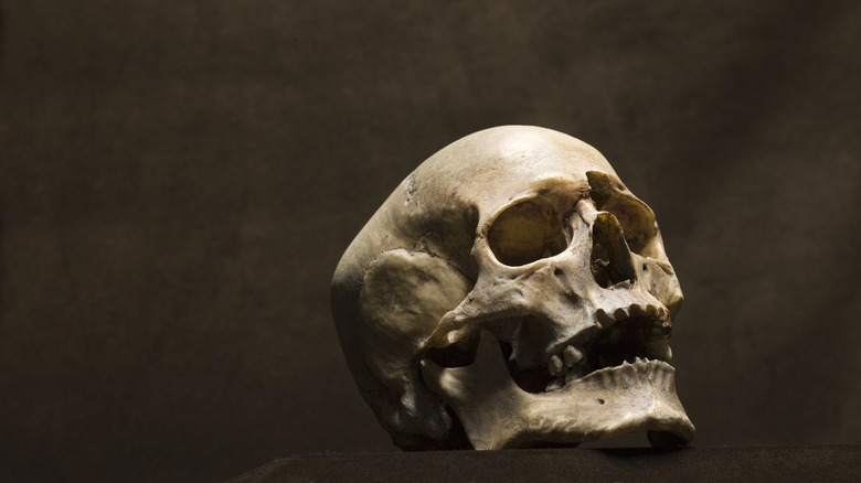 model of a human skull