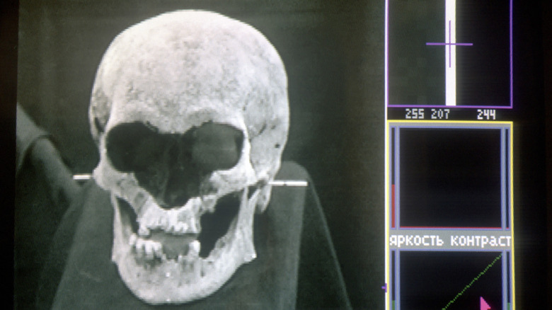 Analysis of discovered skull