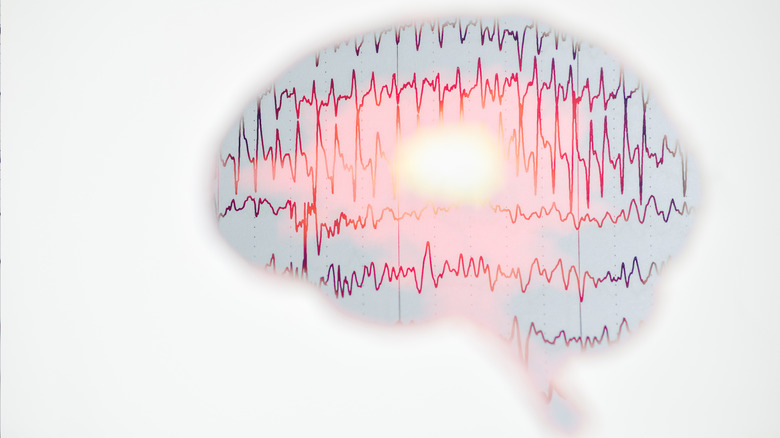 Graph superimposed on brain