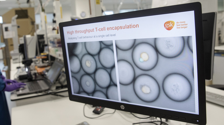 Laboratory computer displaying white blood cells