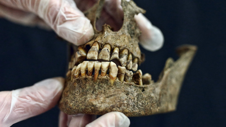 Human jawbone