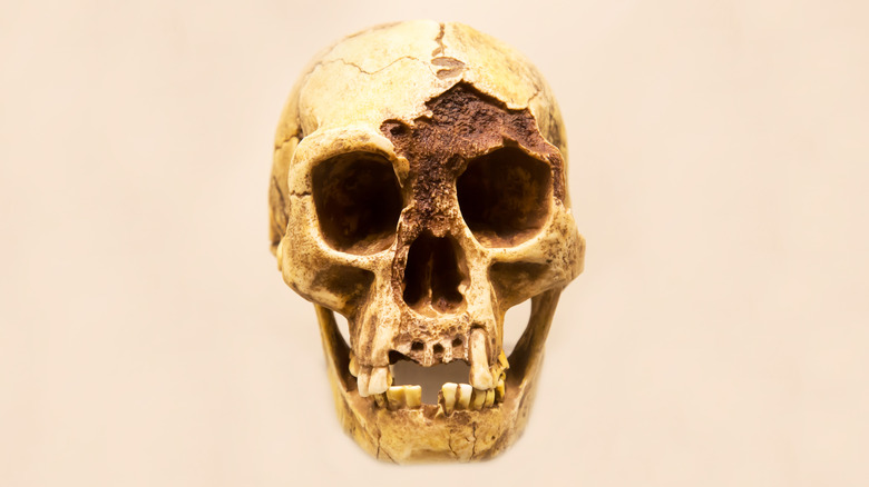 Skull with missing teeth