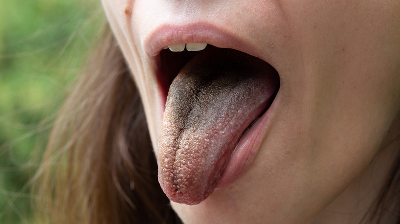 Black hairy tongue side angle