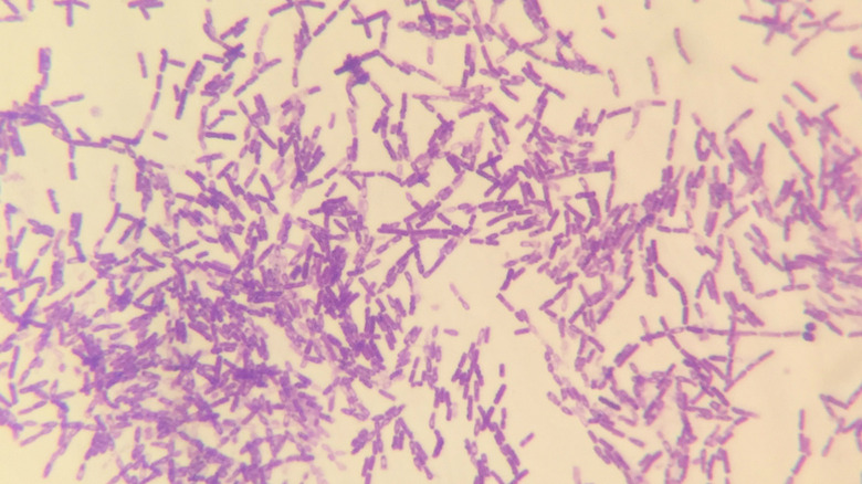 Bacillus anthracis