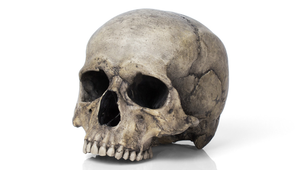 Partial human skull