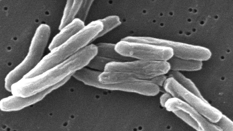 Tuberculosis bacteria under magnification