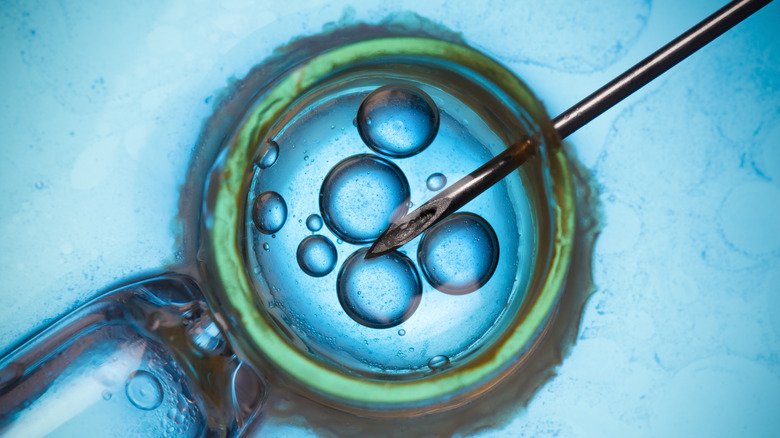 cell during an IVF procedure