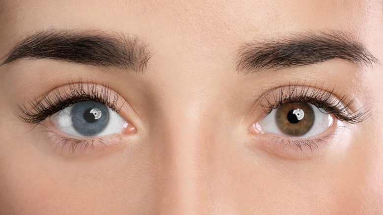 woman with different color eyes