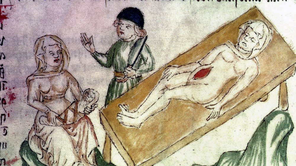 Middle Ages Medicine