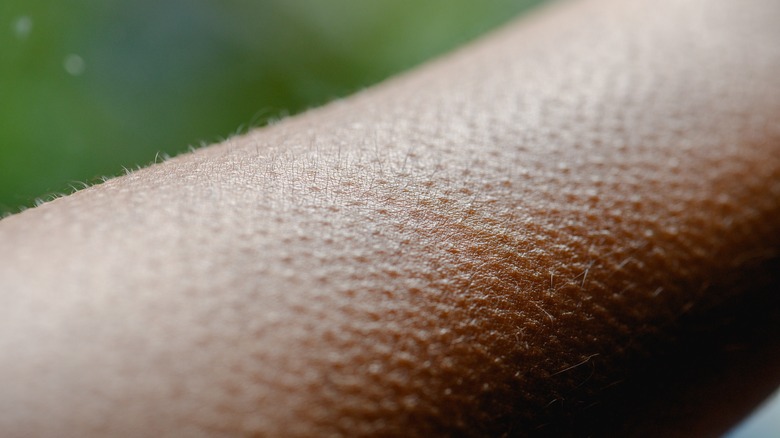 Close up of goosebumps on arm