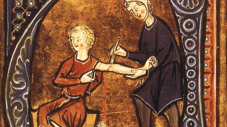 medieval illustration of bloodletting