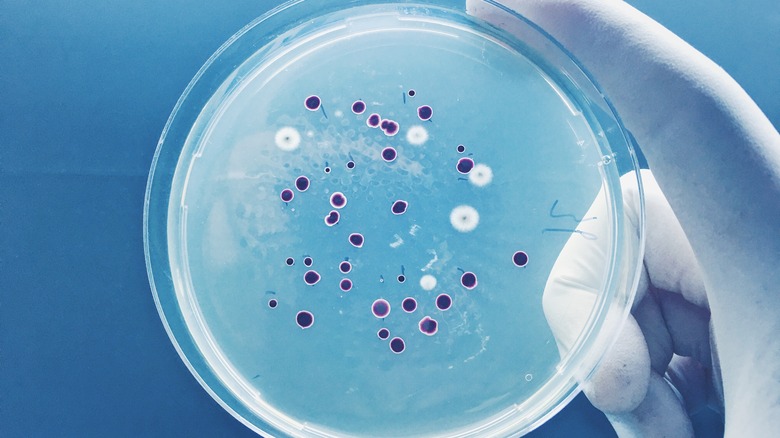 bacterial culture